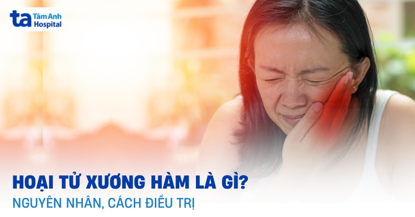Hoại tử xương hàm do đâu? Dấu hiệu và cách phòng ngừa