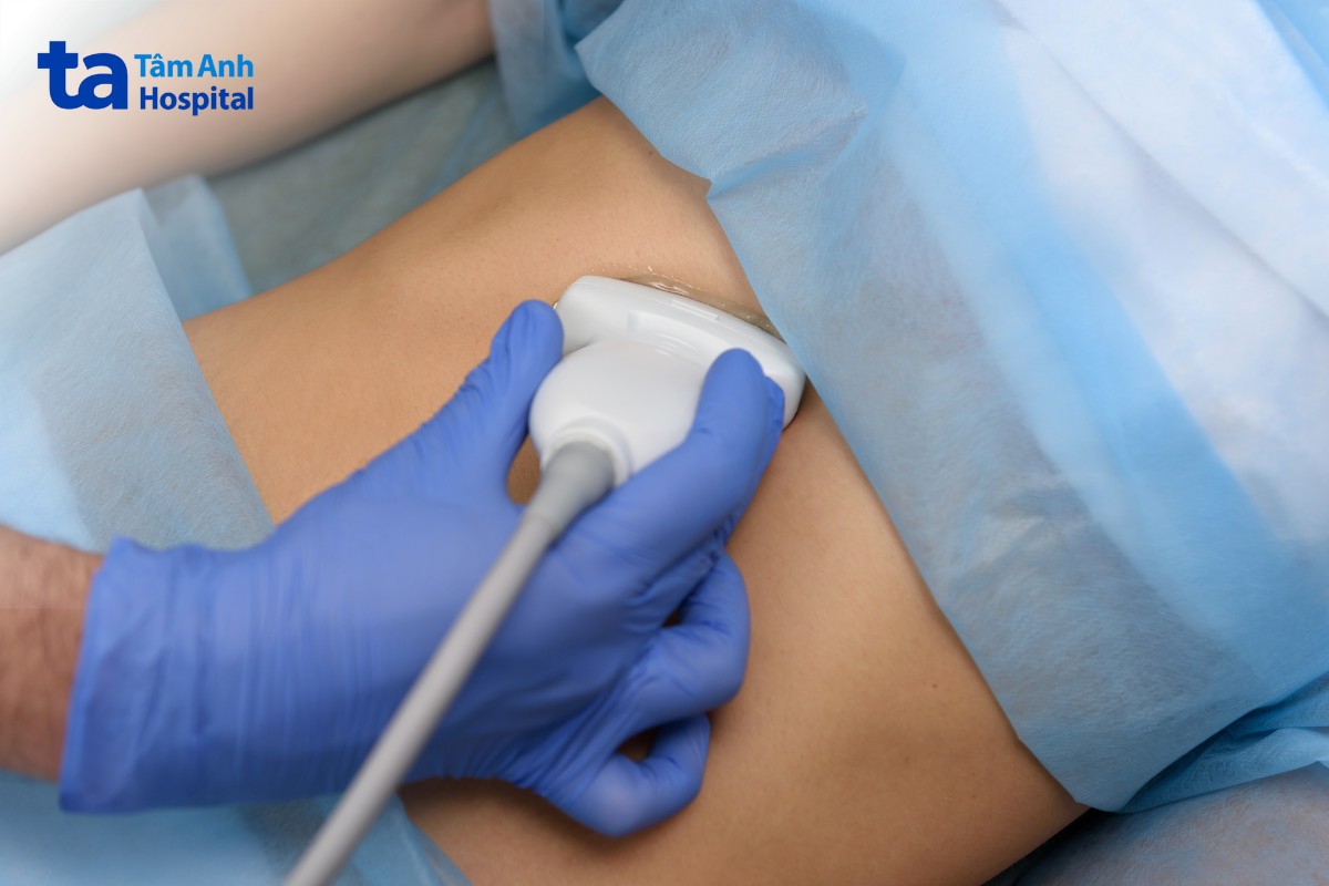 hội chứng hẹp động mạch mạc treo tràng trên