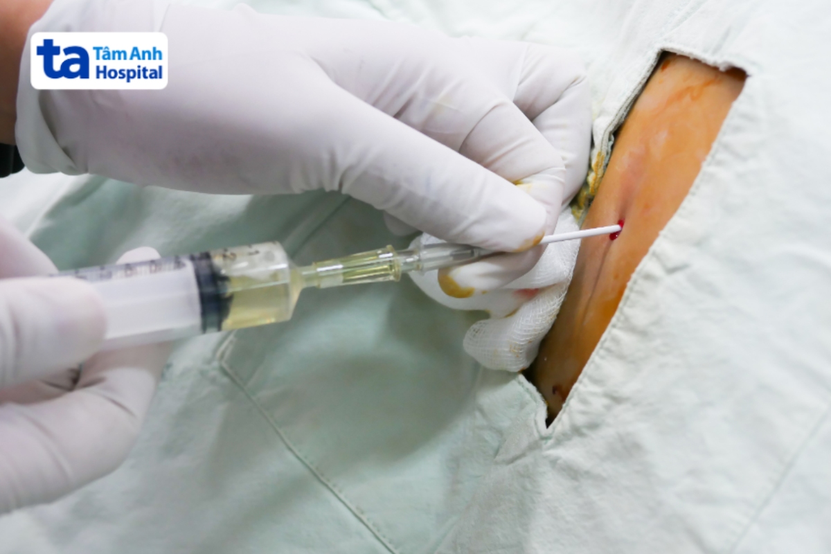 lấy một lượng dịch phù hợp