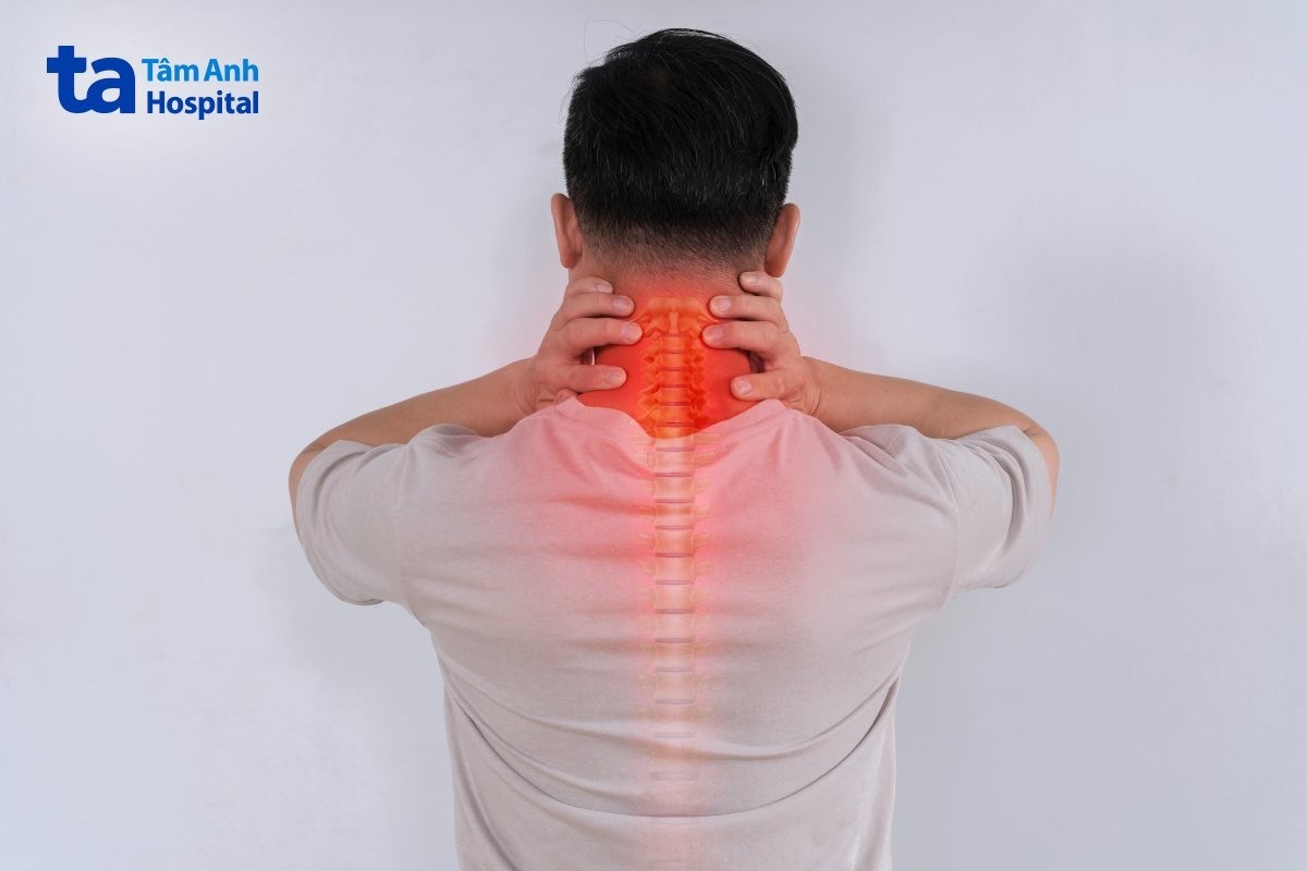 liệt do thoái hóa đốt sống cổ