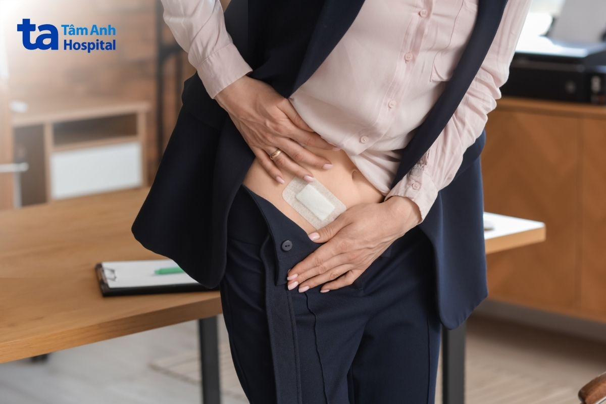 Mổ Ruột Thừa Bao Lâu Đi Lại Bình Thường