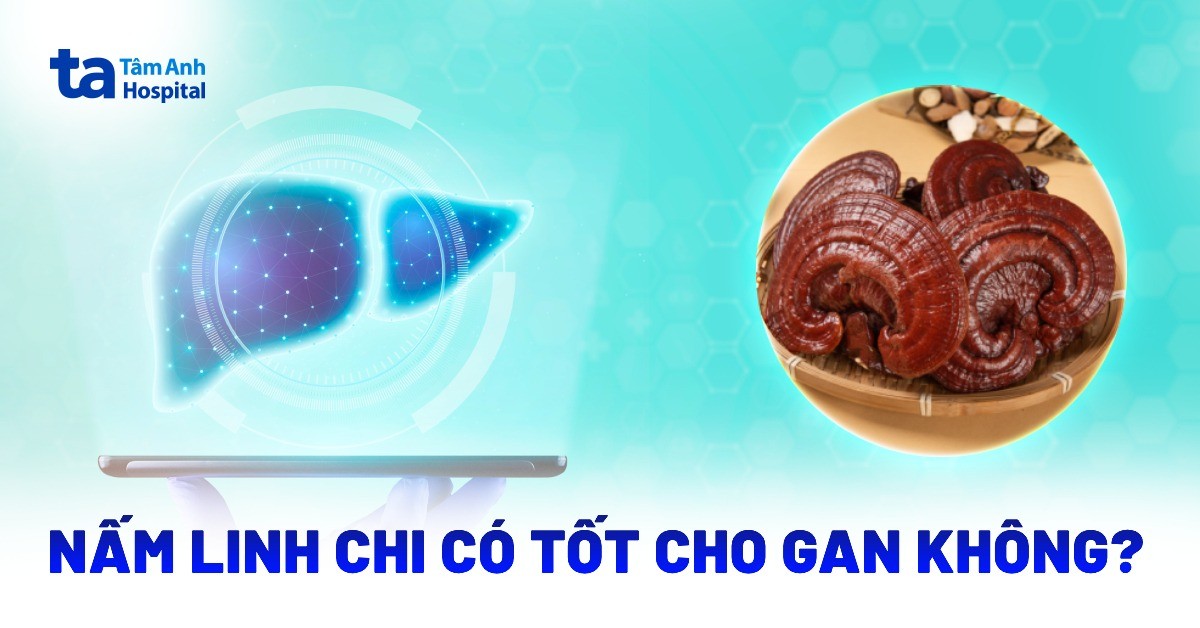 Nấm linh chi có tốt cho gan không? Tác dụng và lưu ý khi sử dụng