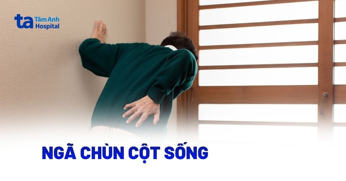 Ngã Chùn Cột Sống