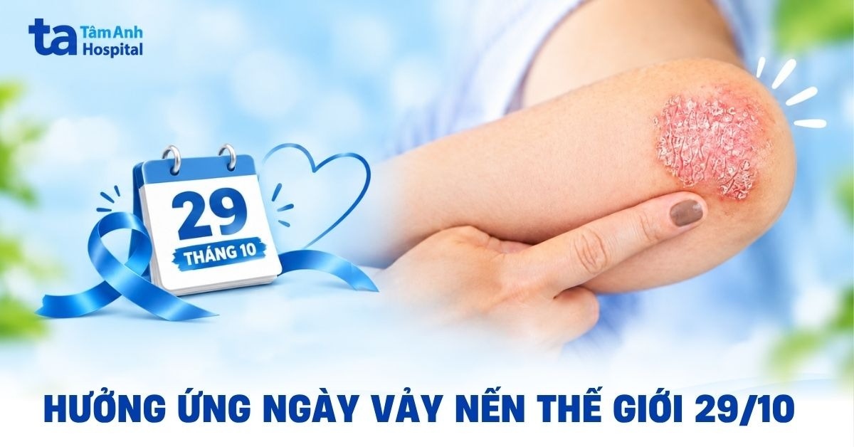 Ngày Vảy nến Thế giới 29/10: Lịch sử, ý nghĩa và chủ đề