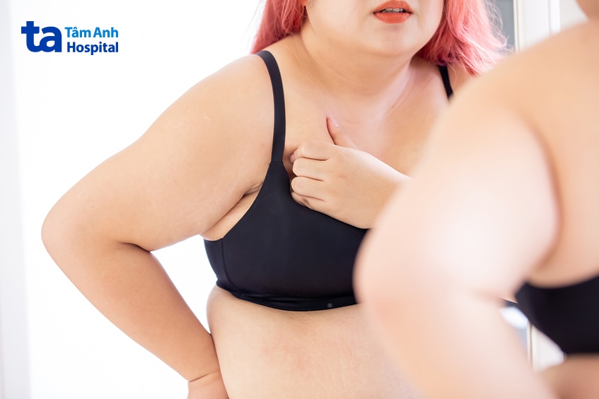 Người phụ nữ thừa cân đứng soi gương kiểm tra cơ thể