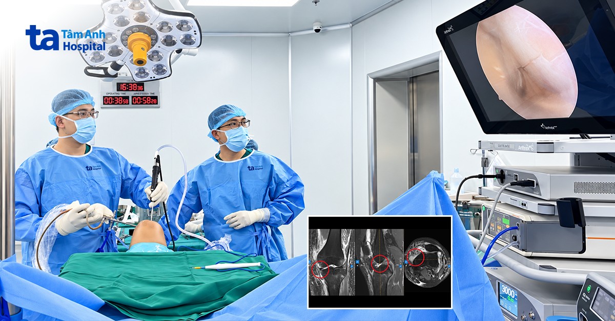 Nữ sinh 16 tuổi đứt cùng lúc ba dây chằng