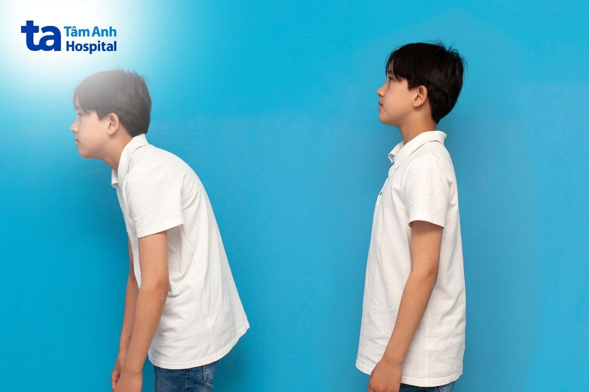 phẫu thuật cột sống ngực