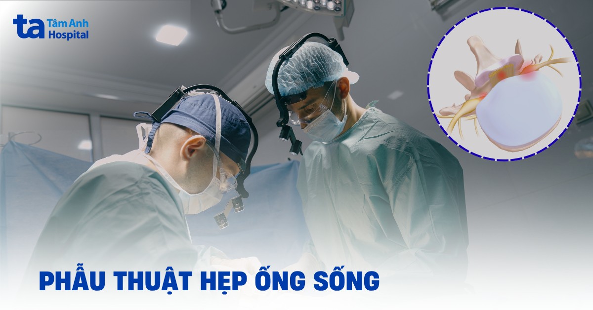 Phẫu thuật hẹp ống sống gồm những kỹ thuật nào?