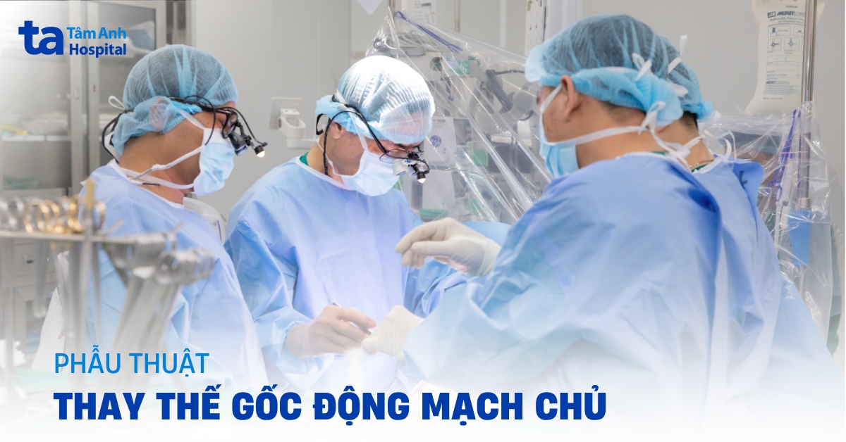 Phẫu thuật thay thế gốc động mạch chủ: Chỉ định và lưu ý