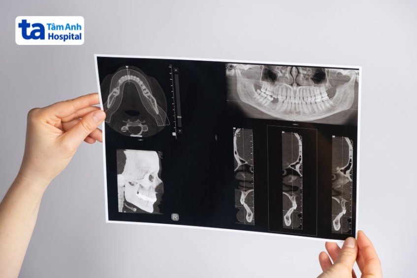 Hai tay cầm phim chụp CT Scan vùng xương hàm mặt và cung răng