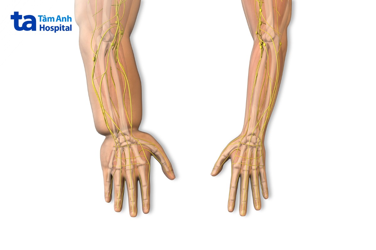 Phù Bạch Mạch Sau Điều Trị Ung Thư Khiến Tay Sưng Tấy Bất Thường