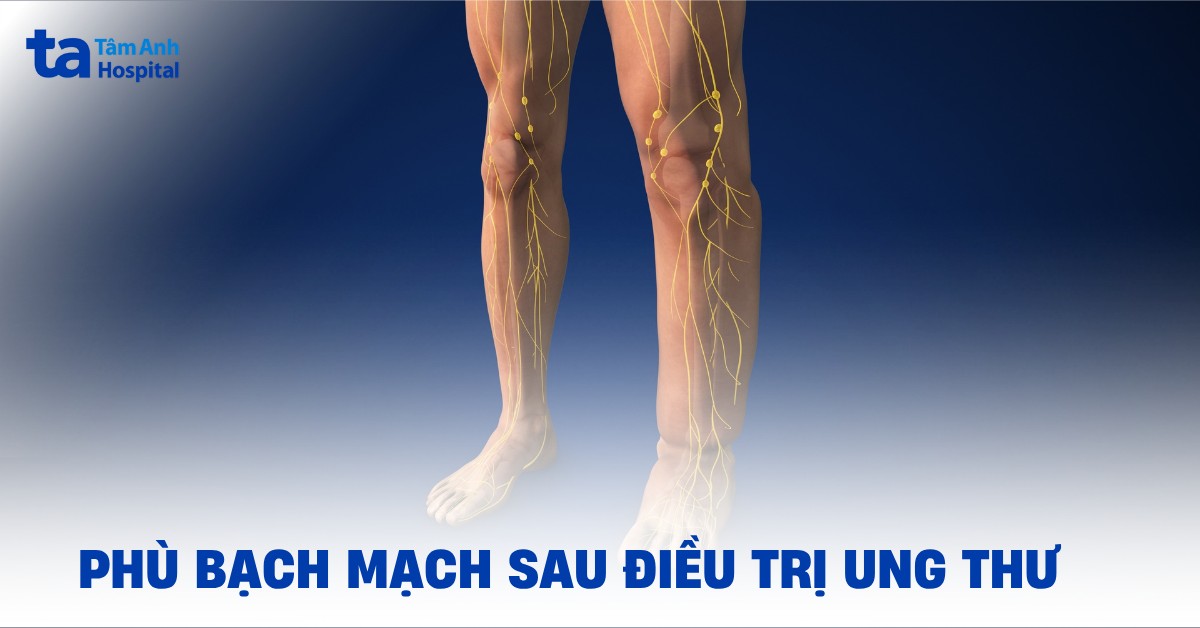 Phù Bạch Mạch Sau Điều Trị Ung Thư
