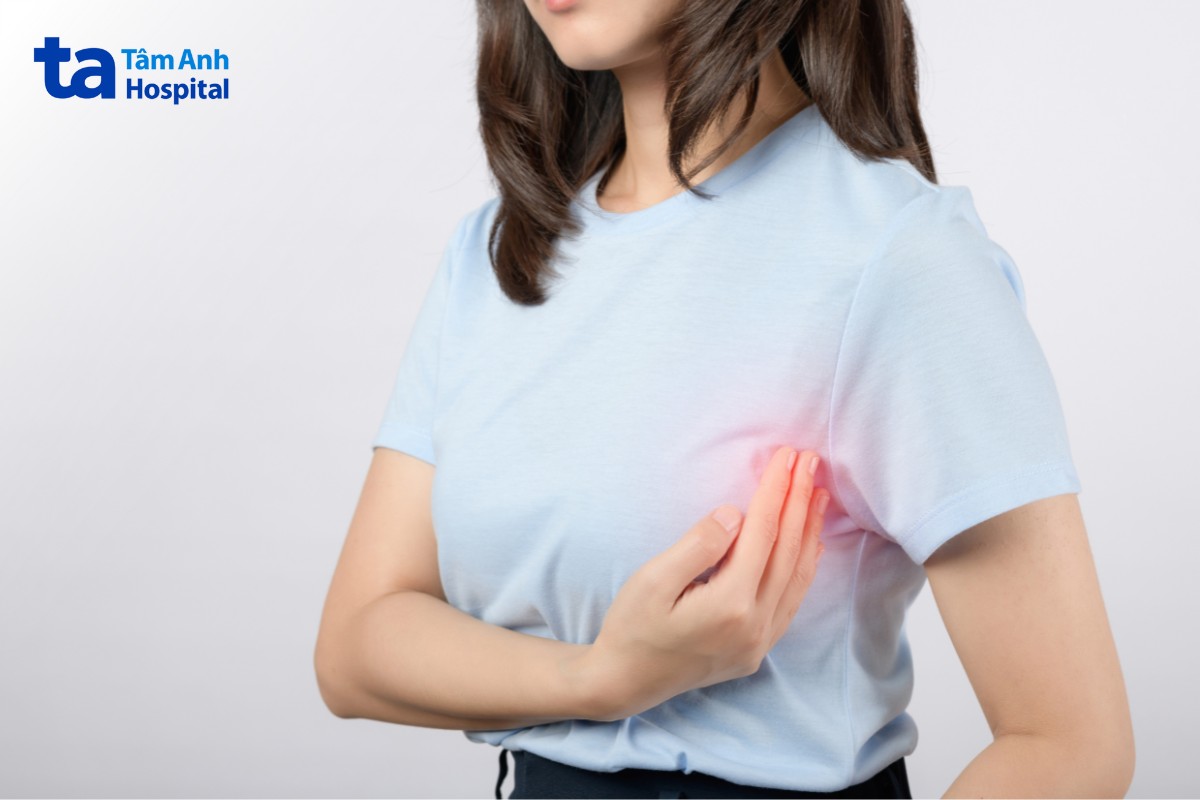 Phù Bạch Mạch Thường Gặp Sau Điều Trị Ung Thư Vú