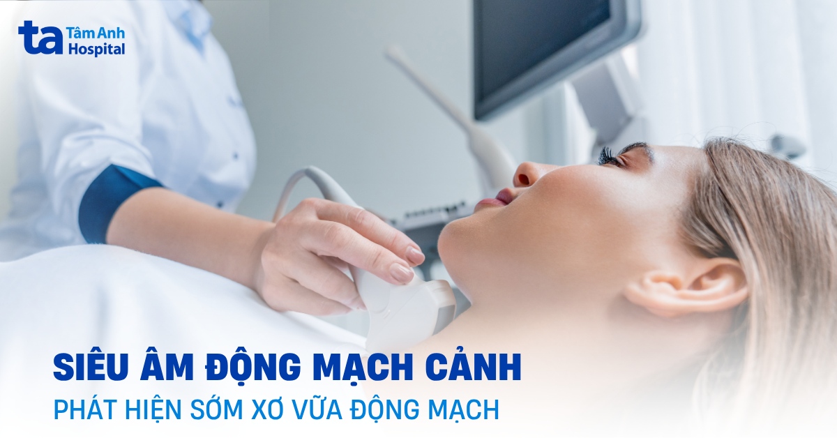 Siêu âm mạch cảnh phát hiện sớm chứng xơ vữa động mạch