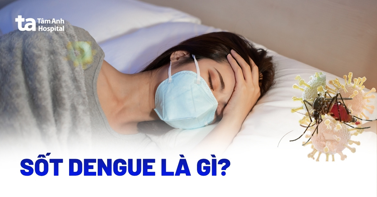 Sốt Dengue