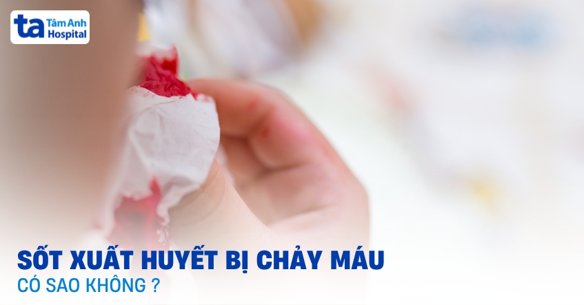 sốt xuất huyết bị chảy máu