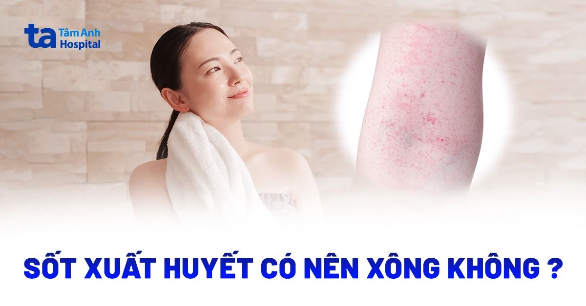 Sốt xuất huyết có nên xông không? Xông hơi, xông lá có tốt?