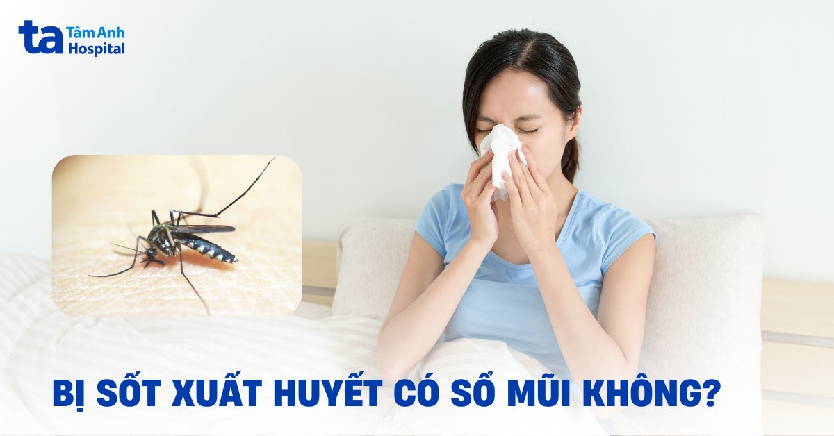 Sốt Xuất Huyết Có Sổ Mũi Không