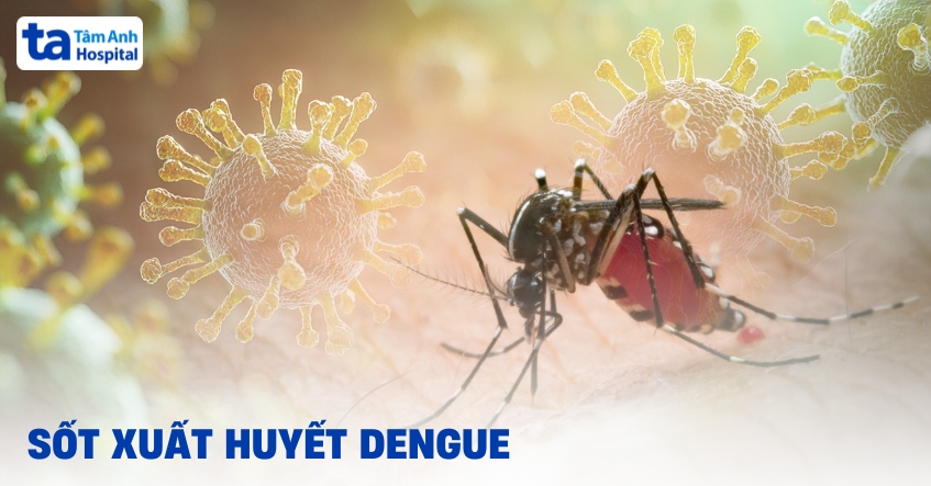 Sốt xuất huyết Dengue và các chi tiết quan trọng