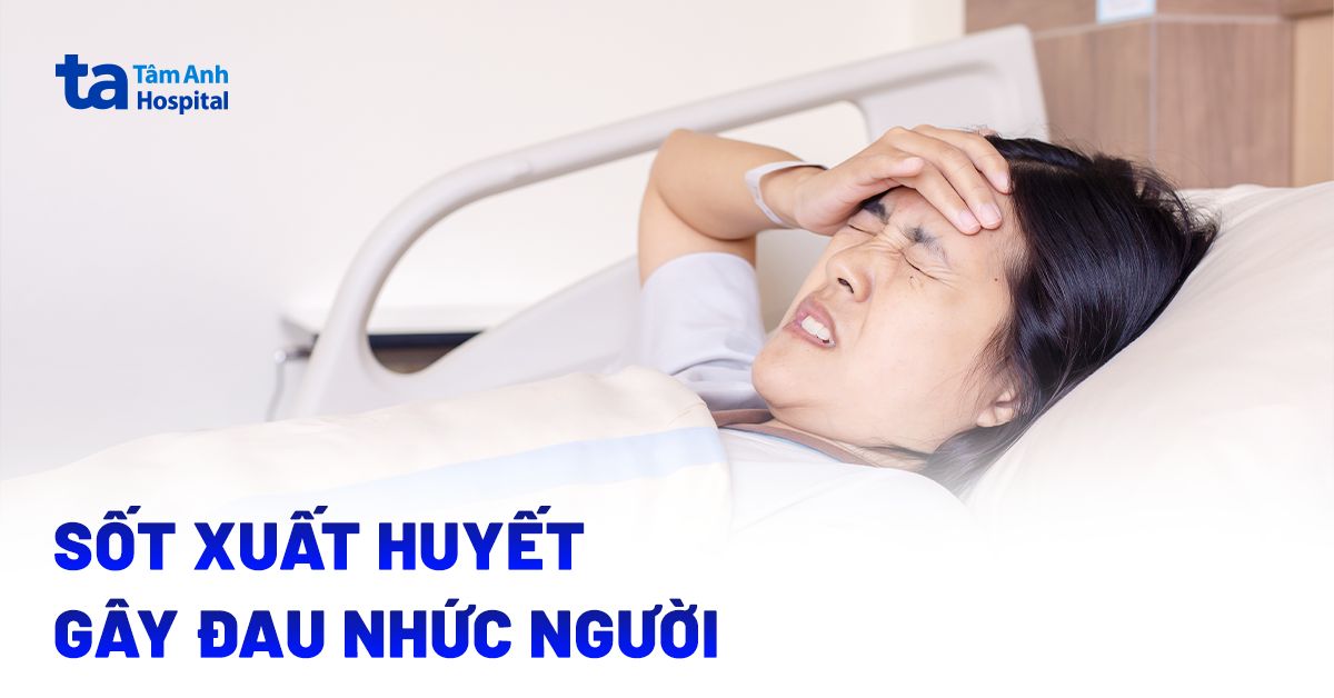 Vì sao sốt xuất huyết gây đau nhức người dữ dội? Cách giảm đau an toàn