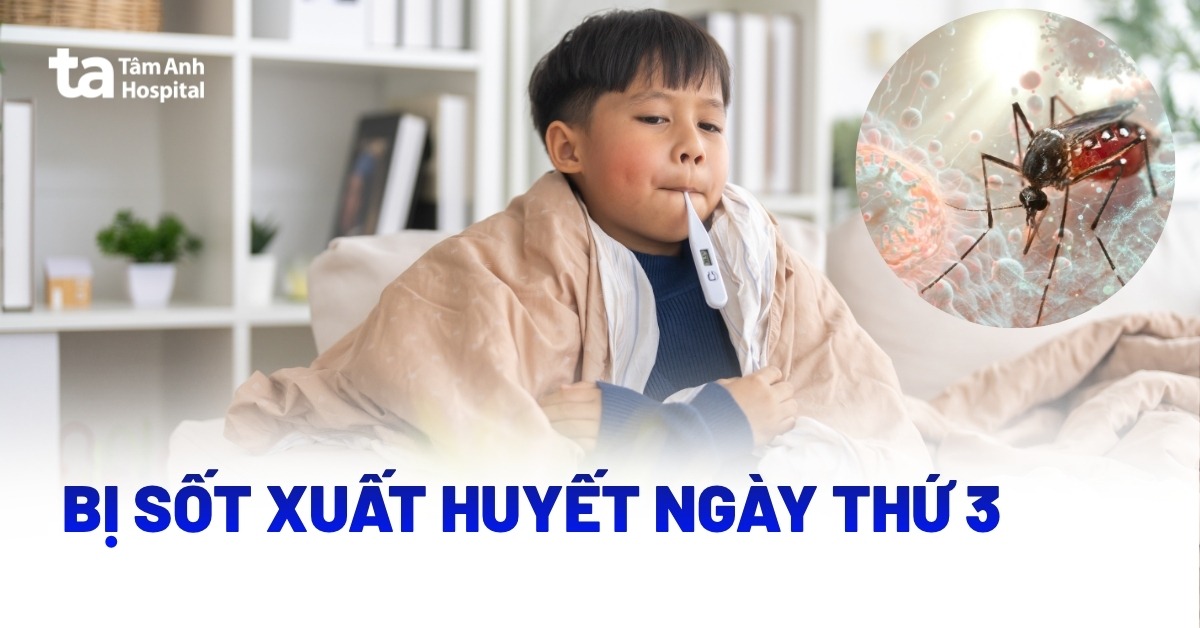 Sốt Xuất Huyết Ngày Thứ 3