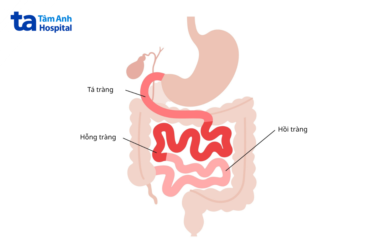 Tá Tràng Là Đoạn Ruột Ngắn Dạ Dày Với Ruột Non