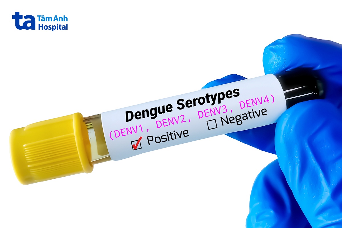 Tác Nhân Gây Sốt Dengue Là Virus Dengue