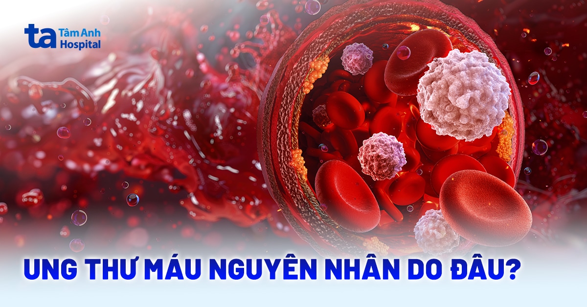 Ung thư máu nguyên nhân do đâu? Chẩn đoán và phòng ngừa
