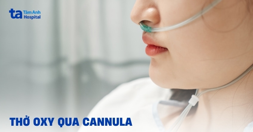 Thở oxy qua cannula là gì? Cách sử dụng đúng và hiệu quả nhất