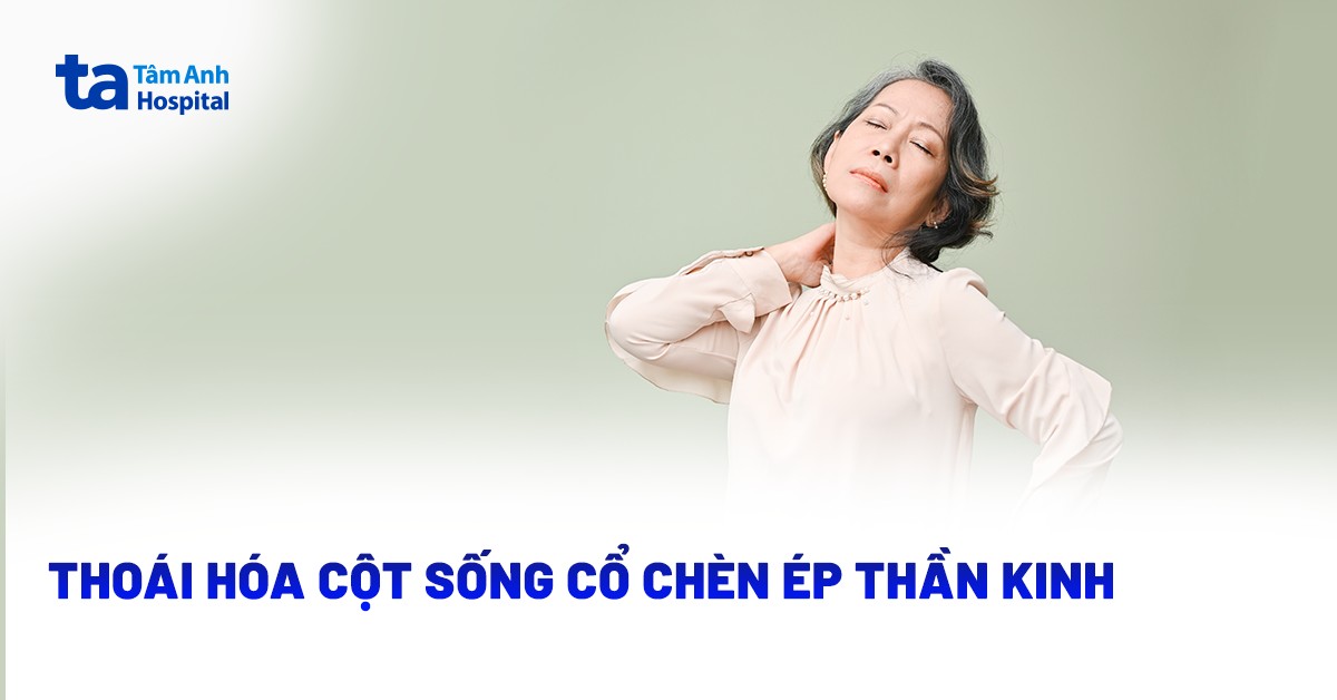 Thoái Hóa Cột Sống Cổ Chèn Ép Thần Kinh
