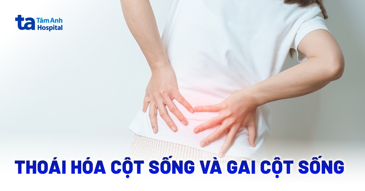 Phân biệt thoái hóa cột sống và gai cột sống như thế nào?