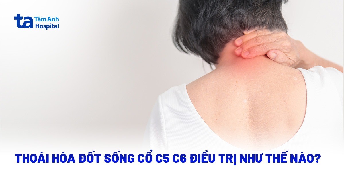 Thoái Hóa Đốt Sống Cổ C5 C6