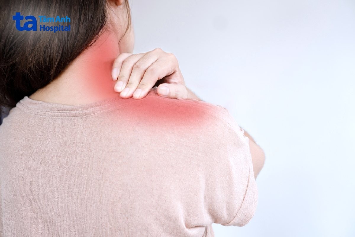 thoái hóa đốt sống cổ gây liệt