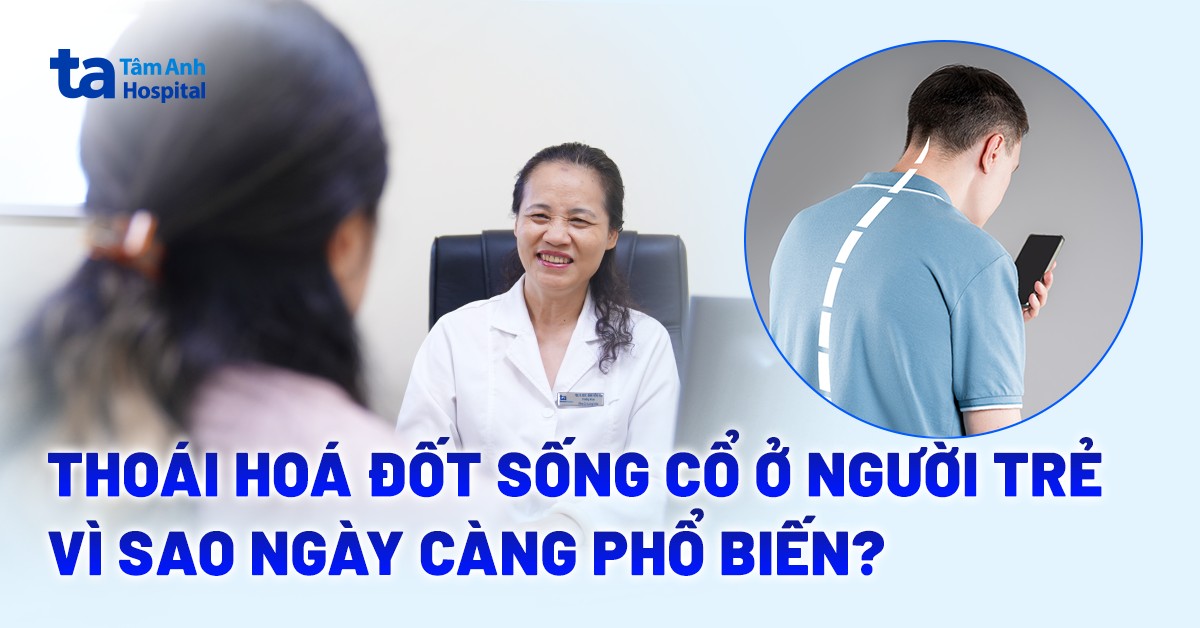 Thoái Hóa Đốt Sống Cổ Ở Người Trẻ