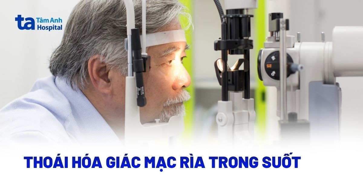 Thoái Hóa Giác Mạc Rìa Trong Suốt