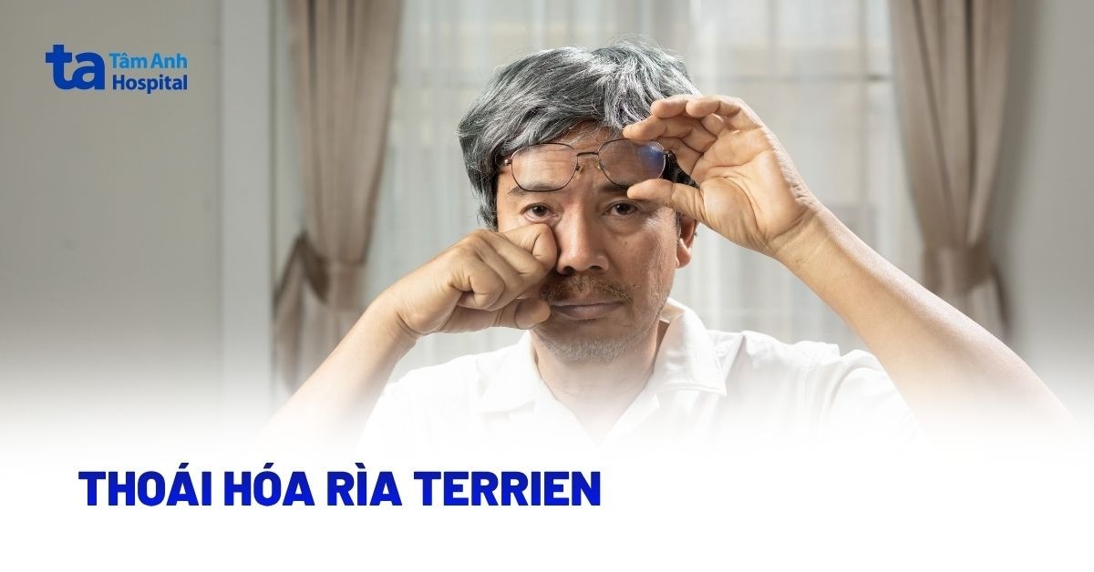 Thoái hóa rìa Terrien: Tìm hiểu thêm chi tiết