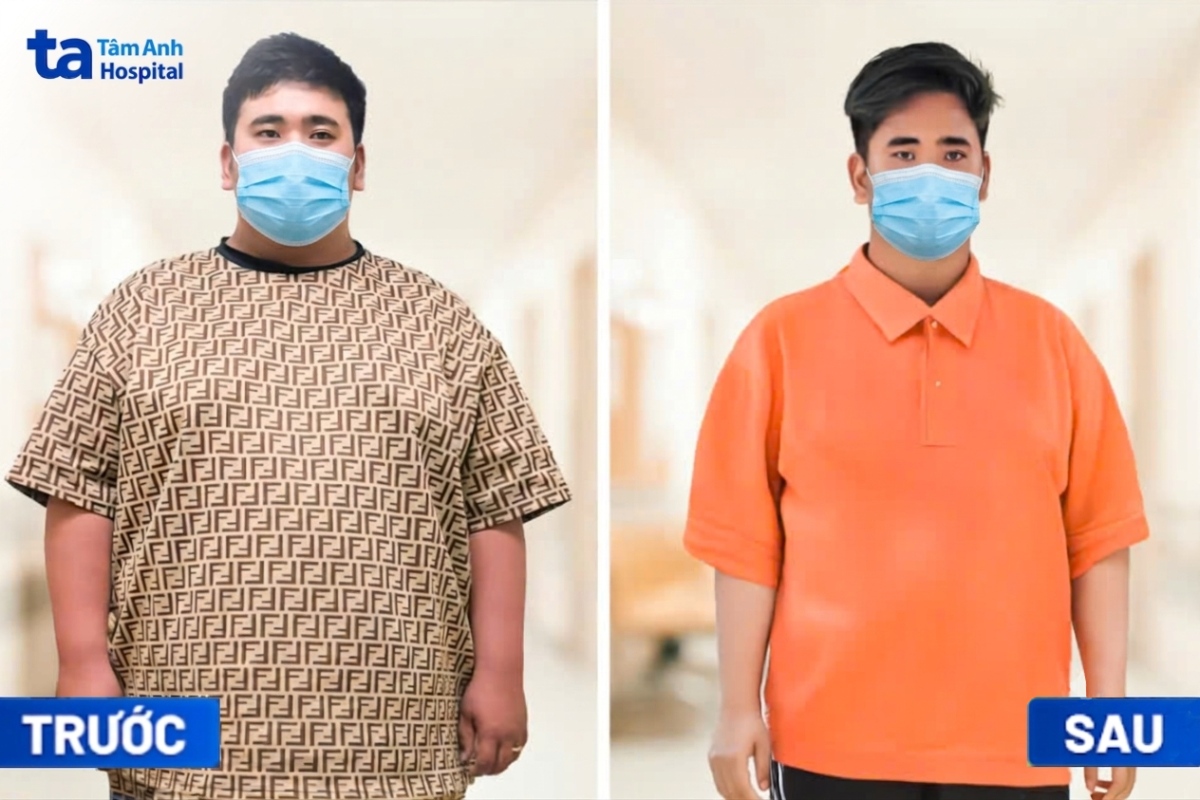 thực trạng dinh dưỡng kép tại việt mam