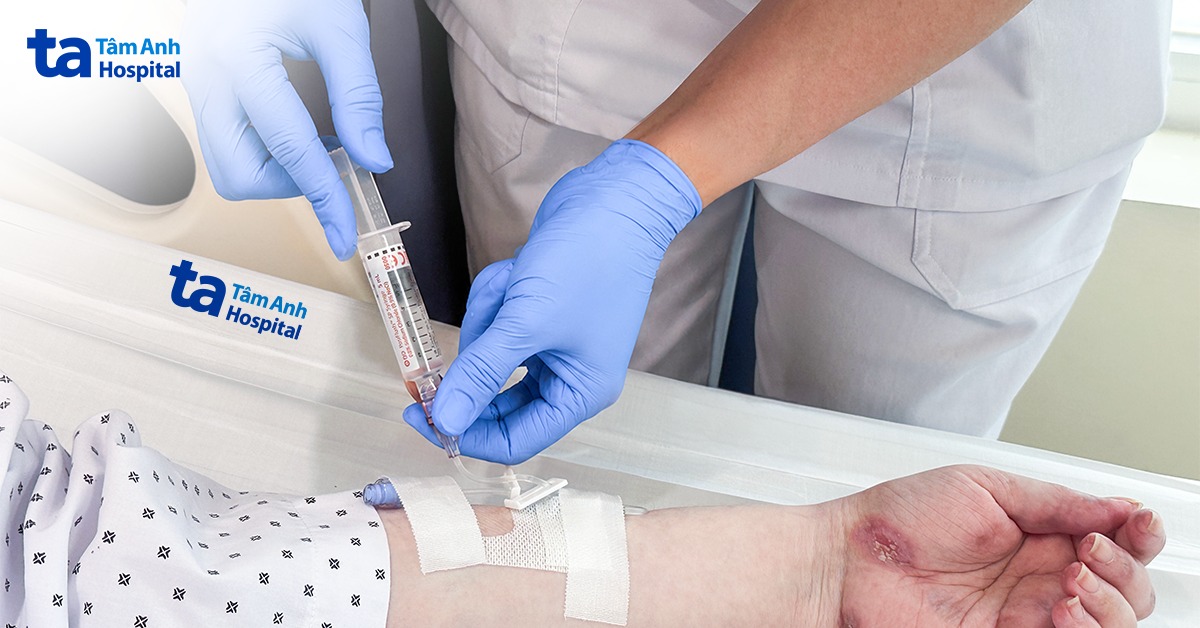Thuốc sinh học – ‘phao cứu sinh’ cho người bệnh lupus ban đỏ