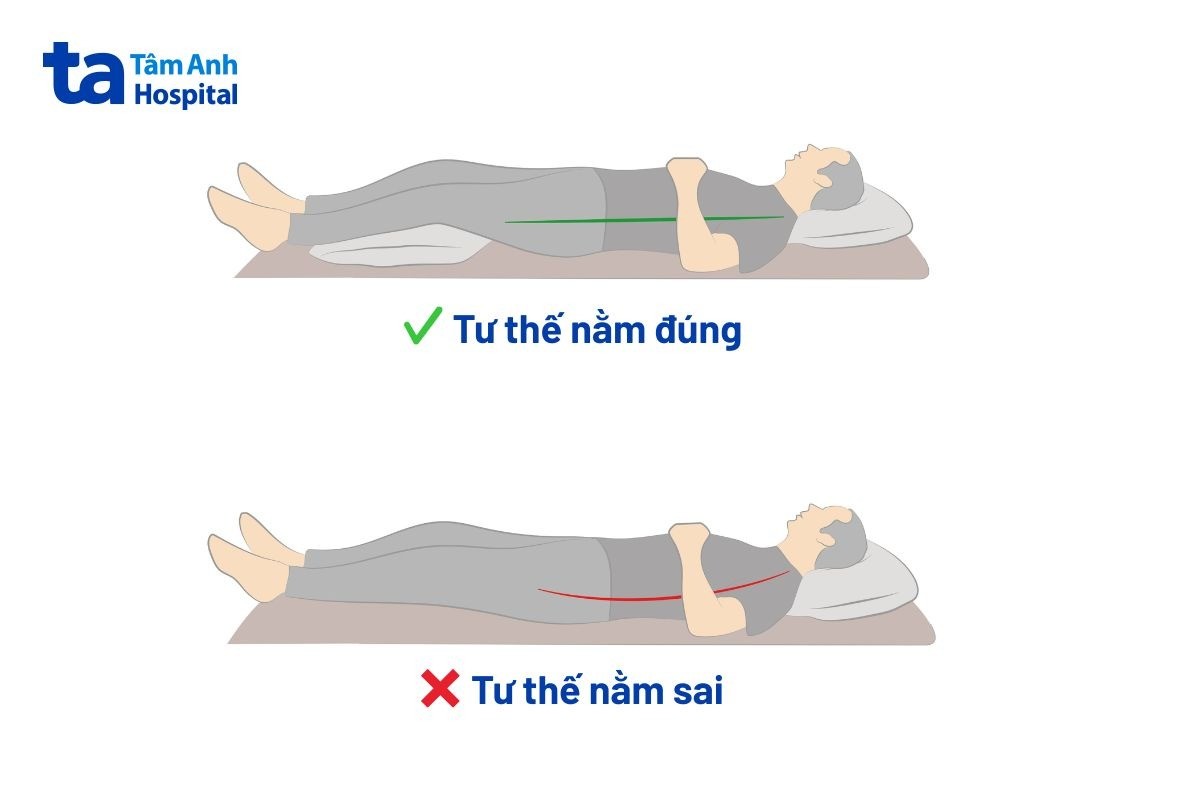 Tư Thế Nằm Cho Người Thoái Hóa Đốt Sống Cổ Giúp Giảm Đau Tư Thế Nằm Khi Bị Thoái Hóa Đốt Sống Cổ