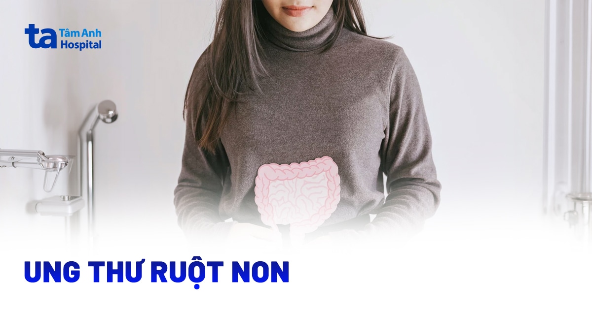 Ung thư ruột non: Các dấu hiệu, chẩn đoán, và cách điều trị