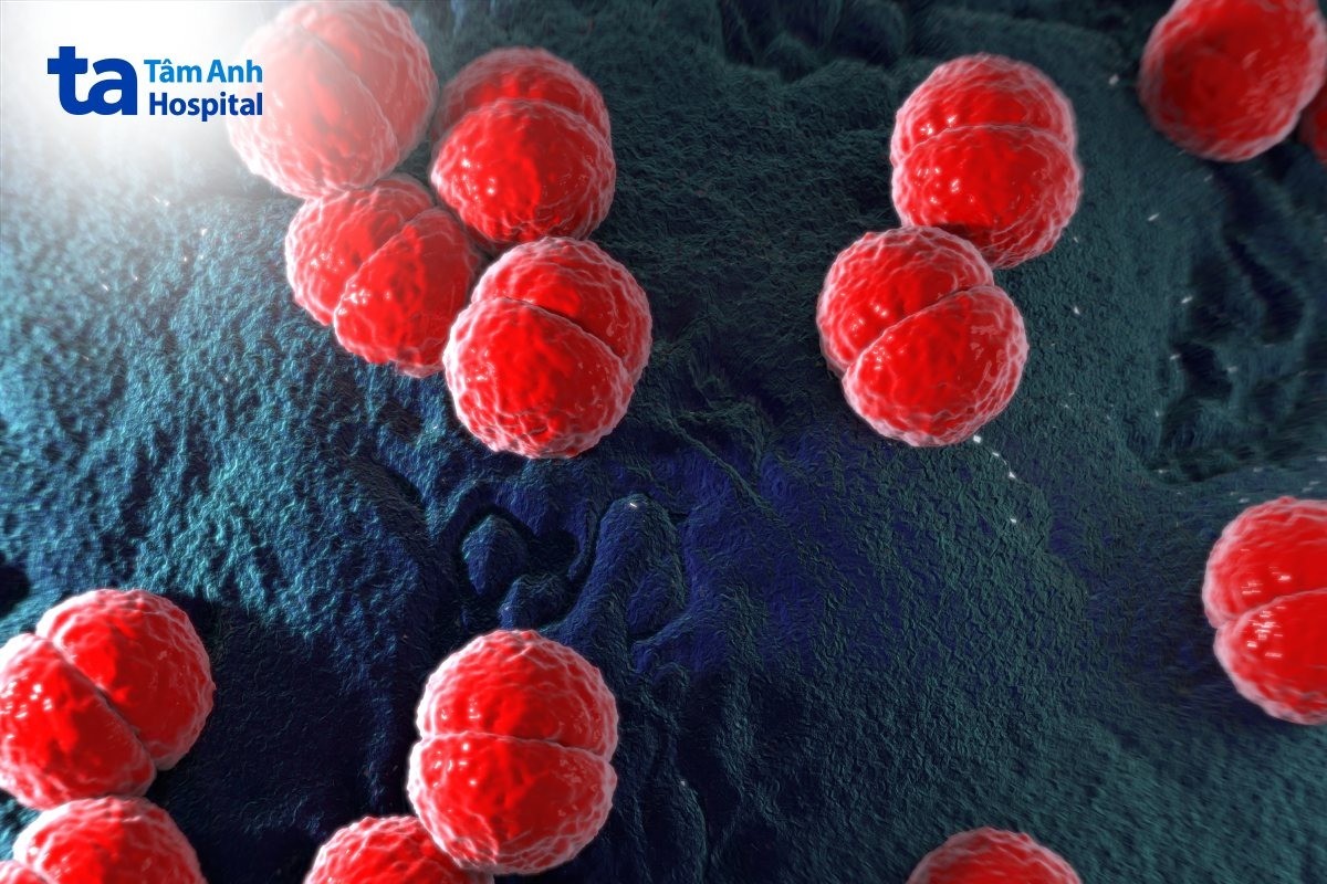 vi khuẩn neisseria meningitidis gây viêm màng não mô cầu