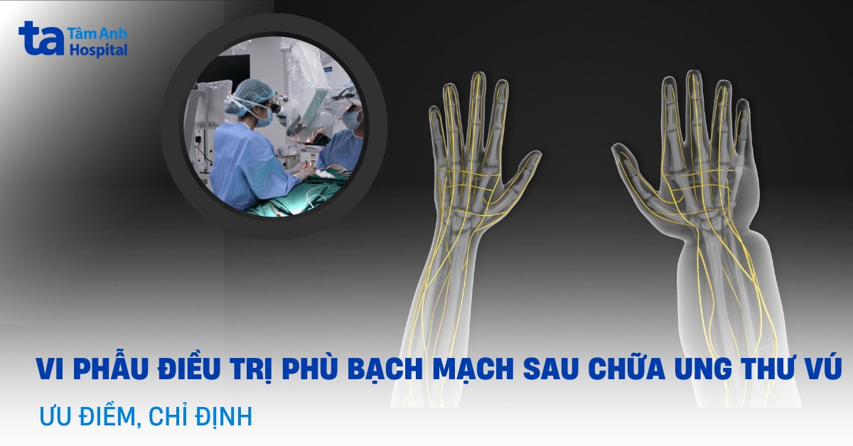 Ứng dụng kỹ thuật vi phẫu điều trị phù bạch mạch