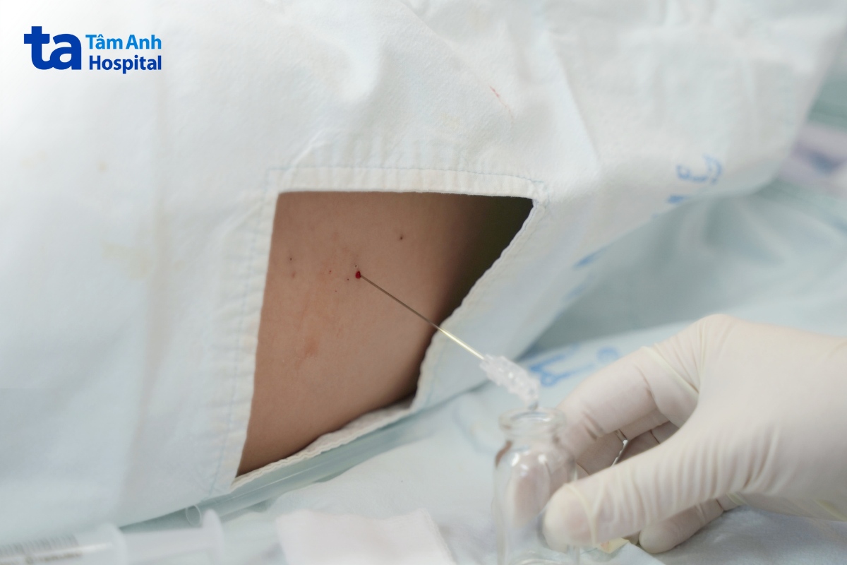 viêm não là bệnh gì
