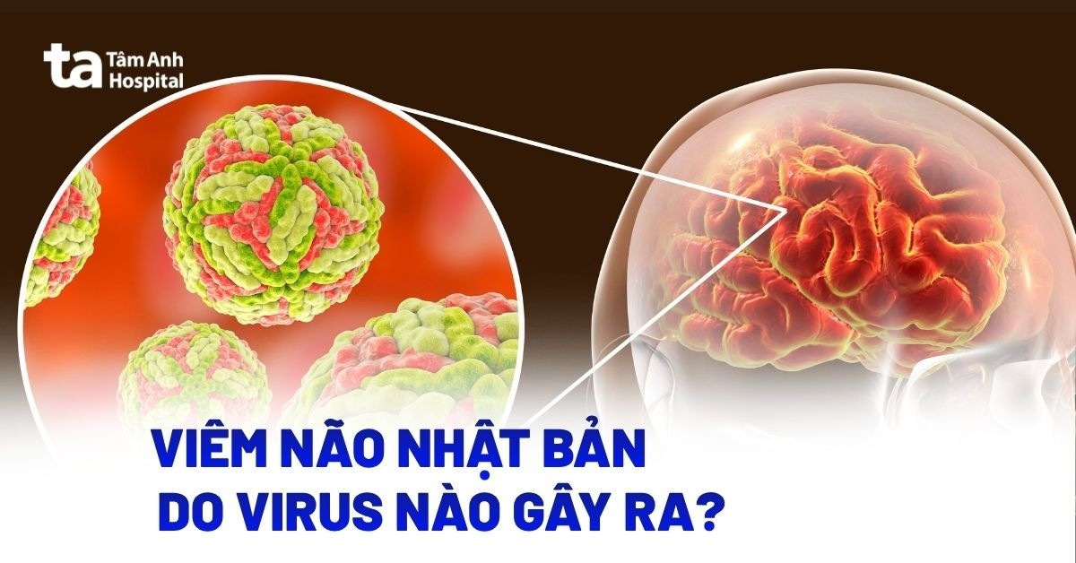 Bệnh viêm não Nhật Bản do virus nào gây ra?