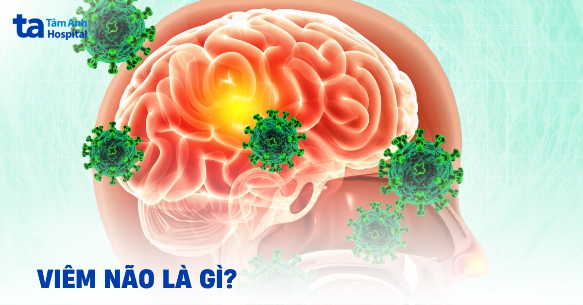 Bệnh viêm não là gì? Những điều cần biết để bảo vệ sức khỏe