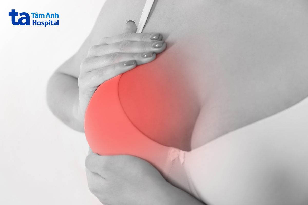 vú có tình trạng to đầy, căng tức bất thường có thể liên quan đến tình trạng tụ dịch quanh túi ngực