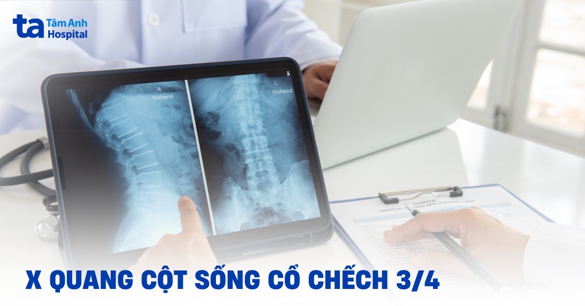 Chụp X quang cột sống cổ chếch 3/4 thực hiện như thế nào?