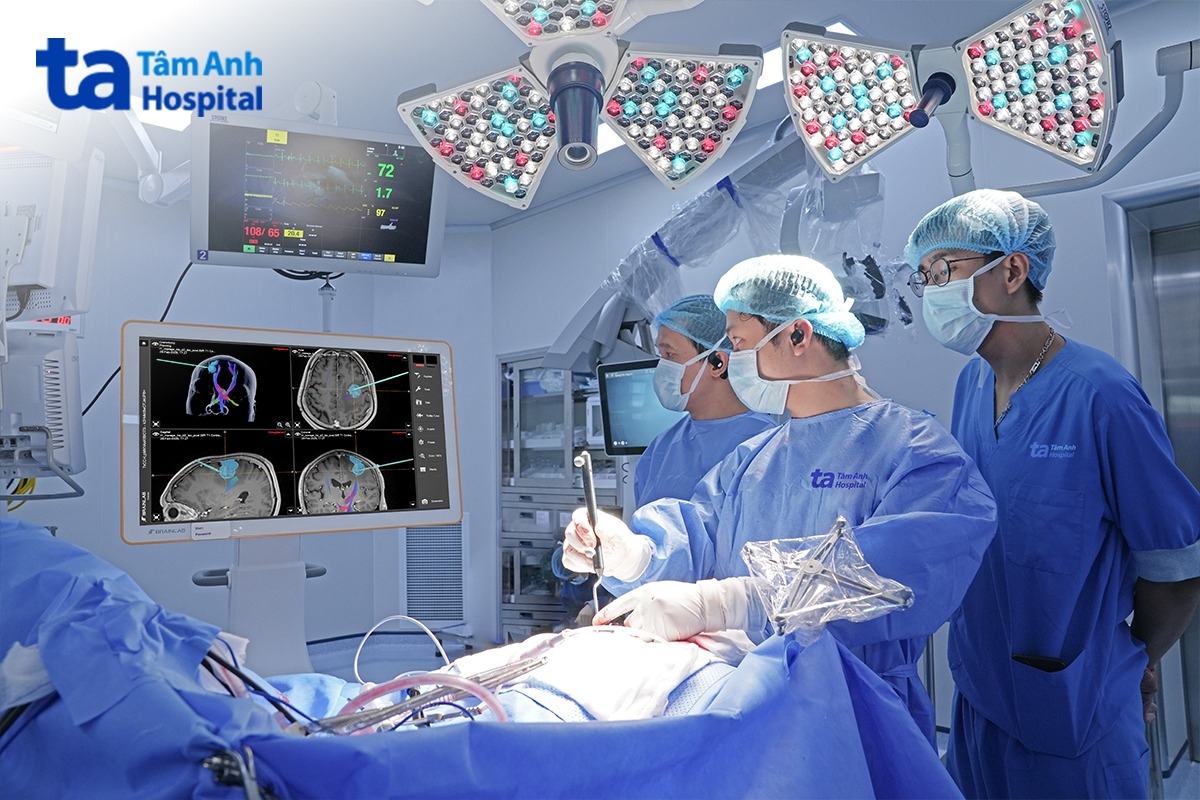 xác định khối u trong não qua hệ thống định vị dẫn đường neuro-navigation curve brainlab
