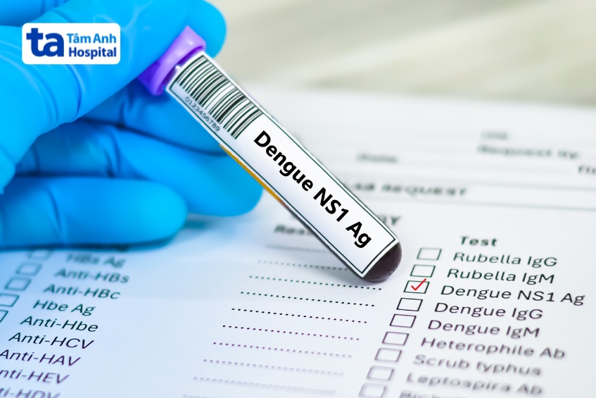 xét nghiệm kháng nguyên dengue ns1