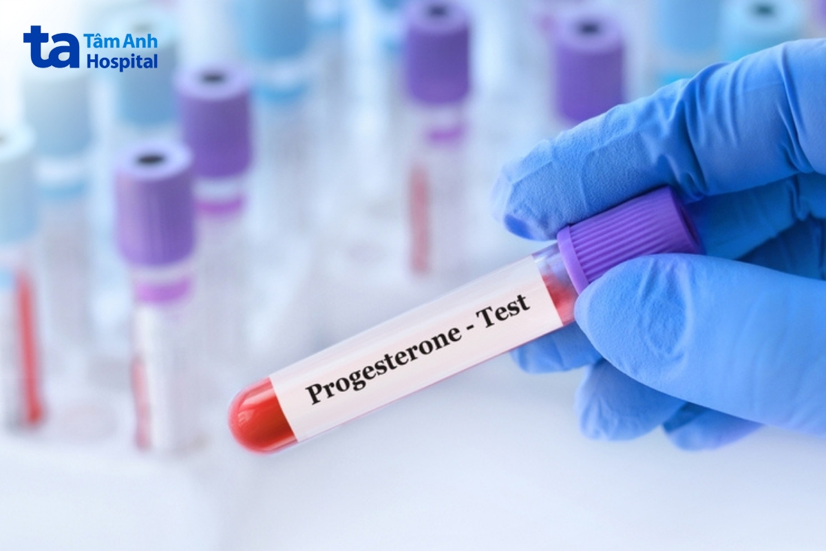 xét nghiệm progesterone cung cấp thông tin quan trọng để chẩn đoán mang thai